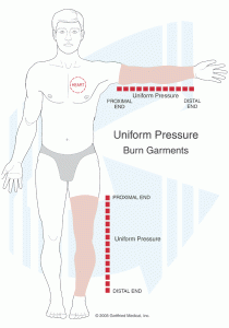 Uniform Pressure Diagram
