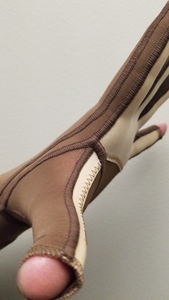 Custom Burn Pressure Garments by Compression Management Services